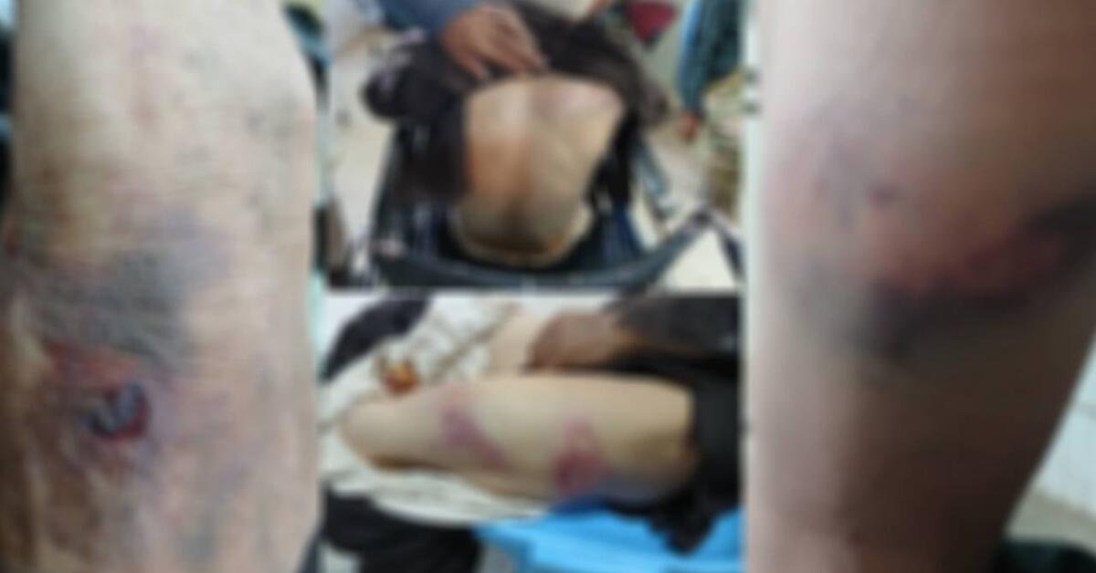 منابع: کوچی‌های مسلح با هجوم به پنجاب بامیان سه کشاورز را لت‌وکوب کرده‌اند