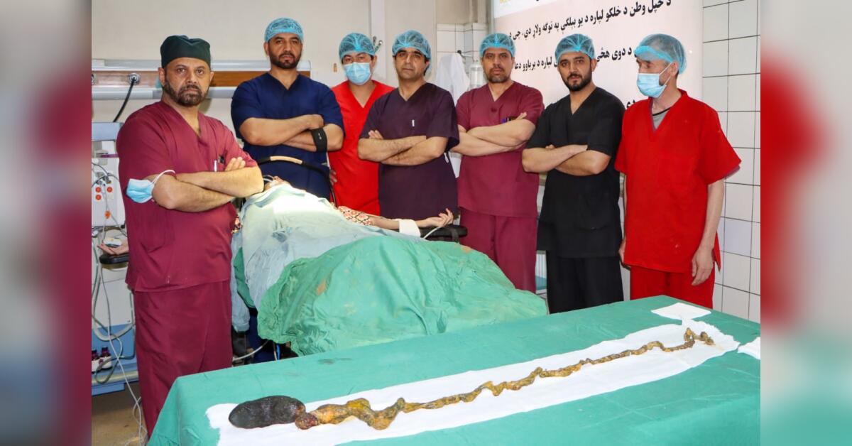 پزشکان شفاخانه داوودخان در کابل عملیات خارج‌سازی کتله موی از معده یک زن را انجام دادند