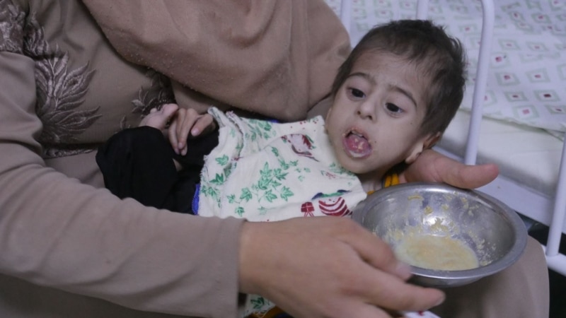 سازمان داکتران بدون مرز: سوءتغذیهٔ شدید کودکان در جنوب افغانستان به‌گونهٔ بی‌سابقه افزایش یافته است