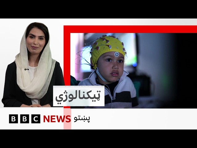 ټکنالوژي:  سکرينونو سره د ماشومانو مخامختيا څومره د دوی پر مغزونو اغېز کوي؟
