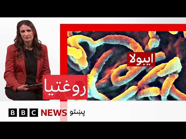 روفتيا: ايبولا څنګه له یوه کس بل ته لېږدي، کوم واکسین او درملنه یې شته؟